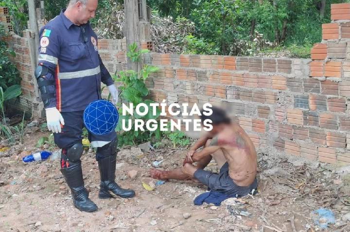Homem fica gravemente ferido após ser espancado por causa de R$ 20