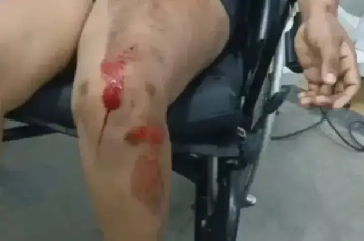 Mulher é socorrida após tentativa de automutilação em residência em RO
