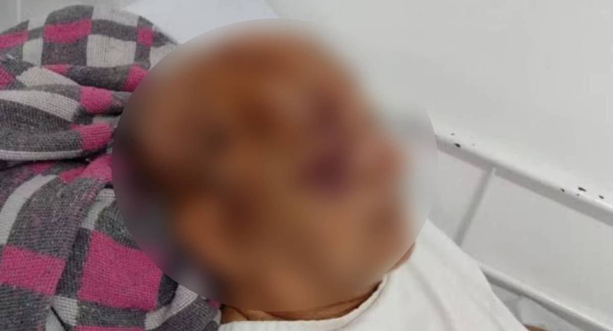 Idoso de 71 anos é agredido pelo próprio filho em área rural de RO