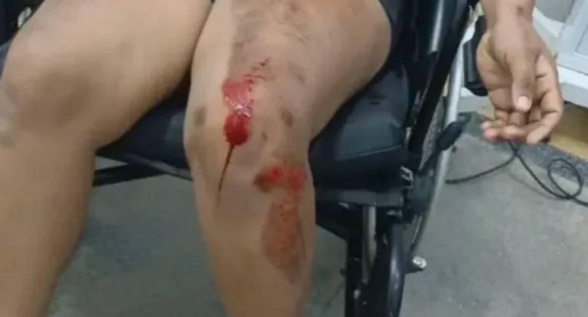 Criança de 8 anos aciona PM depois de pai agredir mãe e deixá-la desacordada em RO